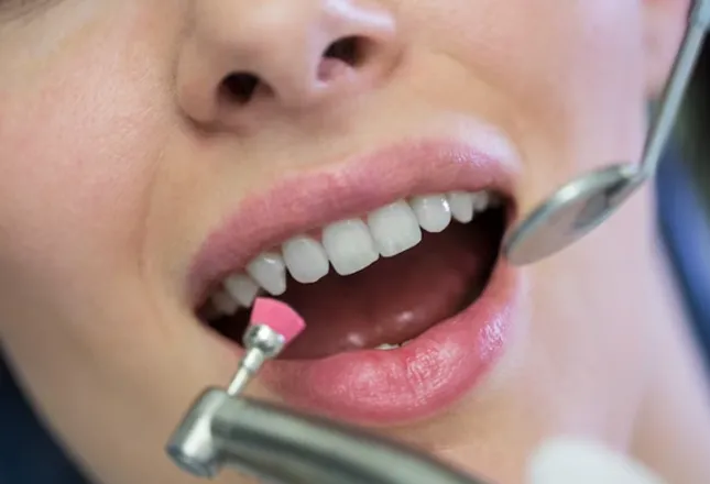 Parodontologie Zahnfleischpflege und -behandlung