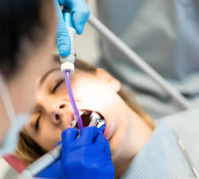 1 Diş Kanal Tedavisi Kaç Dk Sürer?